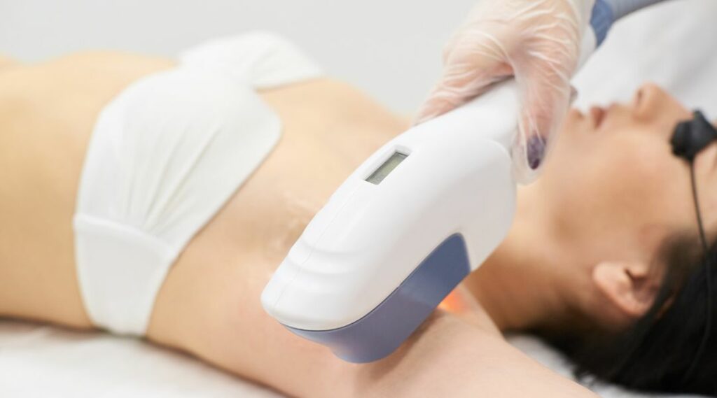 an image showing a lady undergoing a laser hair removal