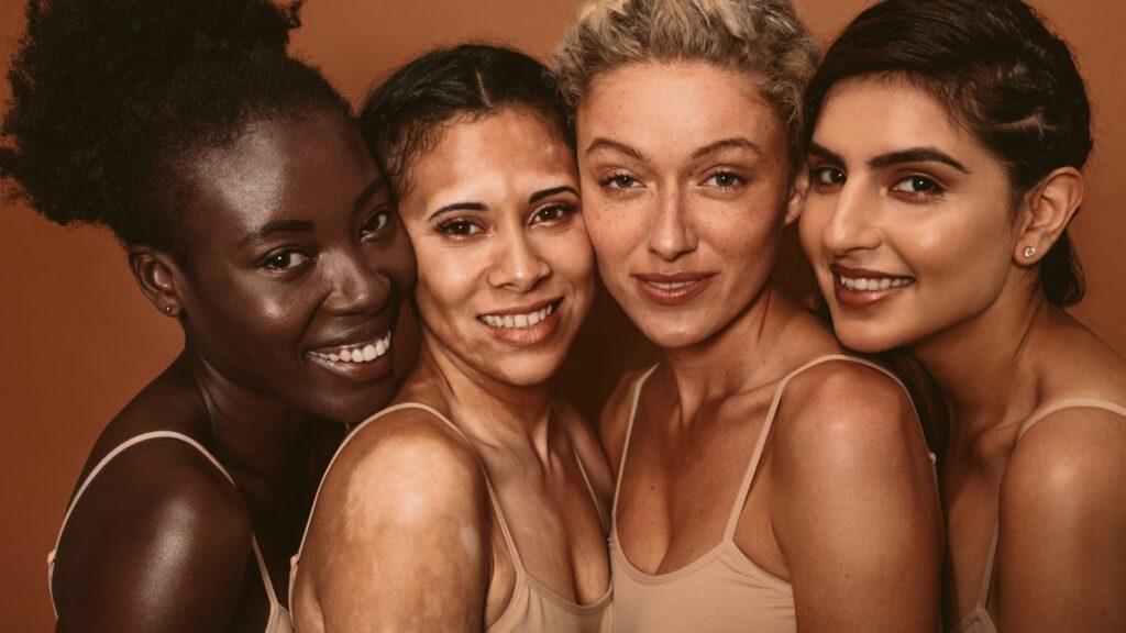 Four women showing different wrinkles.